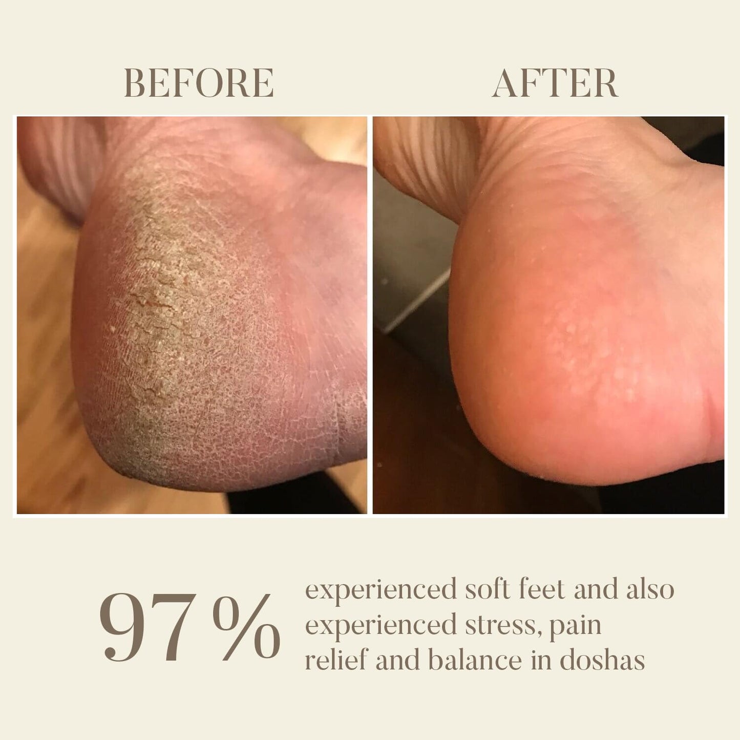 Kansa Wand Foot Massage Tool｜ 純青銅腳部 按摩棒排毒神器